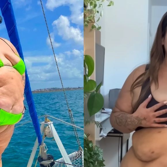Veja o antes e depois de Thais Carla 6 meses após a cirurgia bariátrica