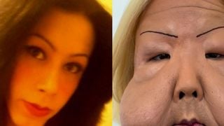 O que aconteceu com Juju do Pix? A linha do tempo da tragédia vivida por influenciadora do RS após injetar óleo mineral no rosto; antes e depois é chocante