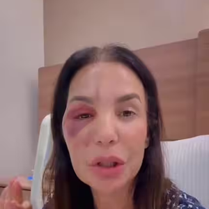 Ivete Sangalo foi confirmada na festa do Big Brother Brasil 26 poucos dias após sofrer uma queda, fraturar dois ossos do rosto e passar por cirurgia na face