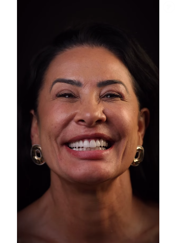 Nos últimos dias, Scheila Carvalho colocou lentes de contato nos dentes