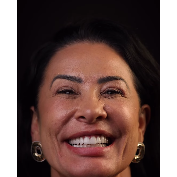 Nos últimos dias, Scheila Carvalho colocou lentes de contato nos dentes