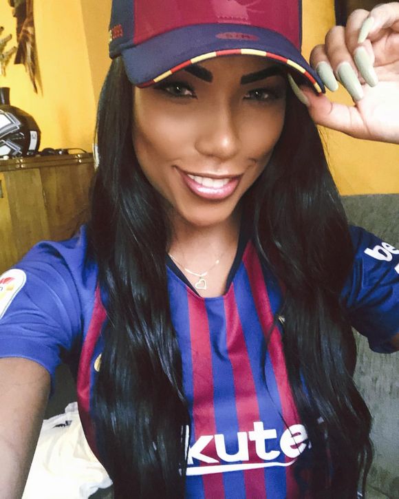 Antes dos procedimentos, Carol Lekker tinha uma boca menos volumosa