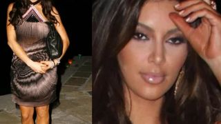 O que é tanorexia? Diagnóstico é um vício perigoso que acomete mulheres no verão; dermatologista alerta: 'Uma distorção da imagem corporal'