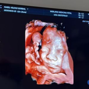 Grávida, Isabel Veloso já mostrou rostinho do bebê em ultrassom