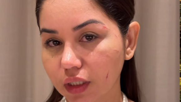 'Vou estourar sua cabeça': vídeo da esposa de Diego, dupla de Victor Hugo, sendo agredida por ex do cantor viraliza na web e Lays Alves mostra rosto ferido