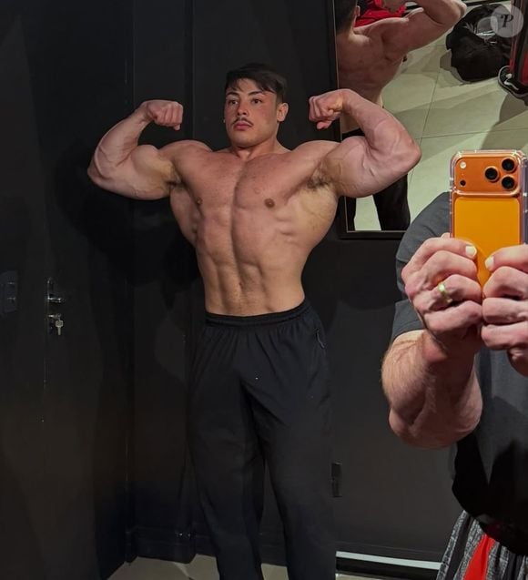 A morte do fisiculturista Gabriel Ganley, de 22 anos, reacendeu o debate sobre os riscos do uso de insulina em protocolos de performance estética. Segundo a endocrinologista Dra. Tassiane Alvarenga, da SBEM, pequenas falhas na administração da substância podem causar hipoglicemia grave, levando até ao coma e à morte