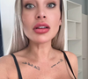 Solteira após o término conturbado com Flávio Gigioli, Andressa Urach passou por uma nova cirurgia em seu rosto
