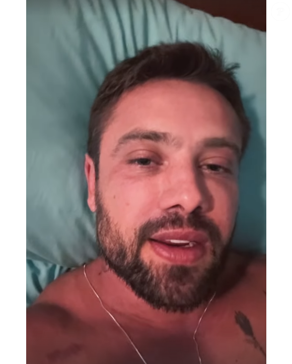 Rafael Cardoso mostrou sua aparência atual e disse que o rosto ainda está inchado devido ao procedimento