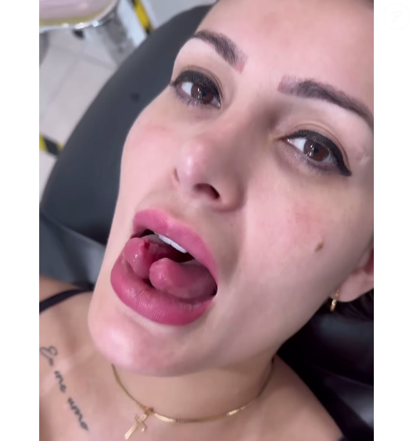 Andressa Urach fez cirurgia de bifurcação da língua em 2024