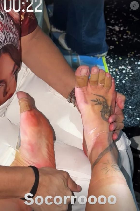 Os pés de Virgínia ficaram em carne viva