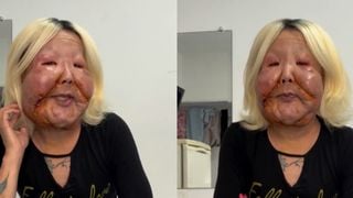Como Juju do Pix ficou após a 2ª cirurgia no rosto? Influenciadora reaparece na web e antes e depois impressiona: 'Do jeito que eu queria'