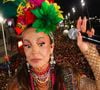 Segundo o dermatologista, Ivete Sangalo gosta de bioestimuladores de colágeno