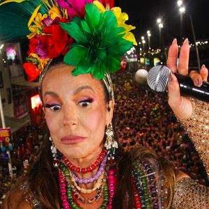 Segundo o dermatologista, Ivete Sangalo gosta de bioestimuladores de colágeno