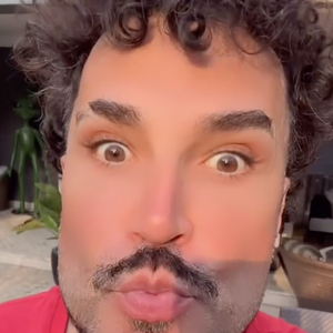 Latino, agora com procedimentos estéticos, deixou internautas chocados por sua transformação