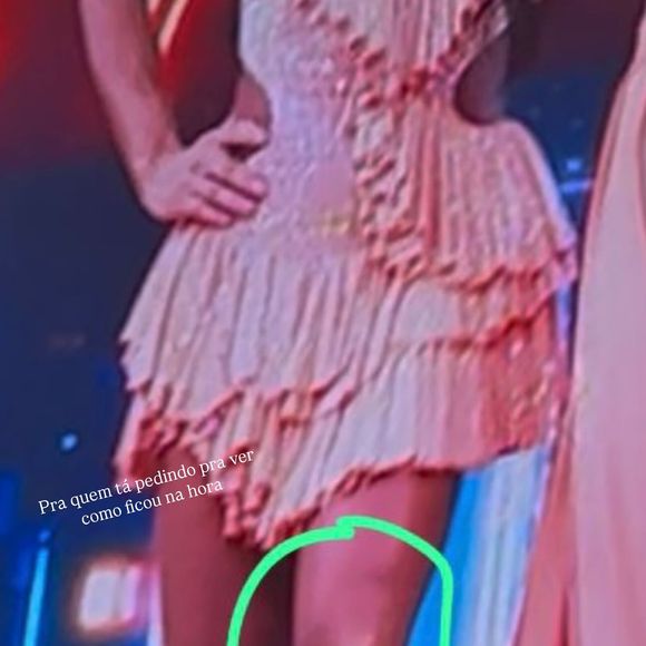 Gracyanne Barbosa mnostrou como o joelho ficou logo após a apresentação