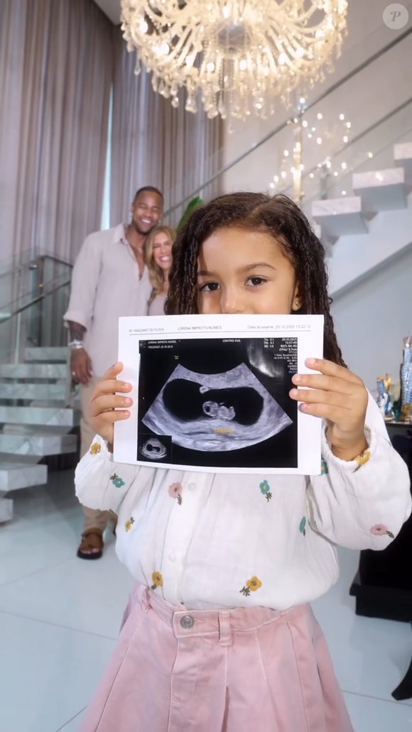 Liz, filha de Leo Santana e Lore Improta, mostrou o ultrassom do bebê em vídeo publicado pela dançarina