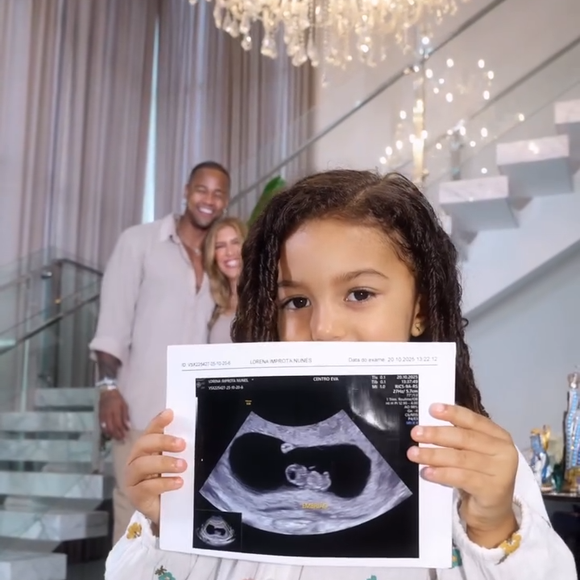 Liz, filha de Leo Santana e Lore Improta, mostrou o ultrassom do bebê em vídeo publicado pela dançarina