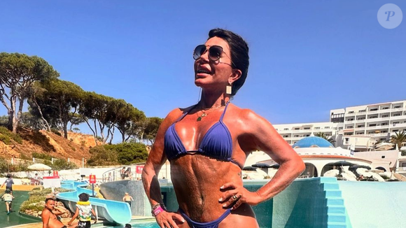 O que é capuzplastia? Gretchen passa por procedimento na região do clitóris e explica motivo: 'Ficou sem forma'