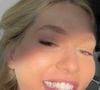 Segundo a Coluna Veja Gente, a popularização do tooth gem entre famosas ajuda a transformar o acessório em uma tendência de estética, mas o odontologista Leonardo Acioli ressalta que a escolha precisa ser acompanhada de cuidados com a saúde bucal