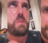 Bruno Gagliasso foi alvo de zombaria do irmão, Thiago Gagliasso: 'E está tudo certo, as pessoas se afastam'