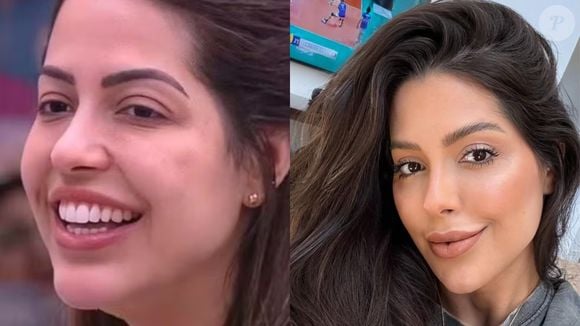 Ex-BBB Laís Caldas tinha as pálpebras bastante volumosas e corrigiu o problema com a blefaroplastia