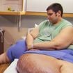 Como está J.T. (Julius) de 'Quilos Mortais' hoje? Rapaz chocou por corpo com 404 quilos, tinha doença na perna e conseguiu emagrecer 270 kg