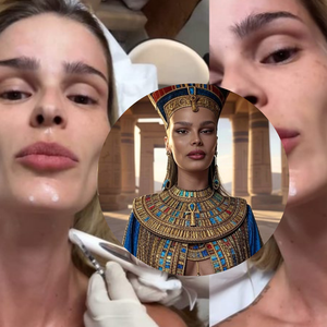 Cara de Cleópatra? Yasmin Brunet faz procedimento estético para suavizar rugas e realçar o contorno da mandíbula inspirado em rainha egípcia; 'Botox Nefertiti!'