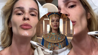 Cara de Cleópatra? Yasmin Brunet faz procedimento estético para suavizar rugas e realçar o contorno da mandíbula inspirado em rainha egípcia; 'Botox Nefertiti!'
