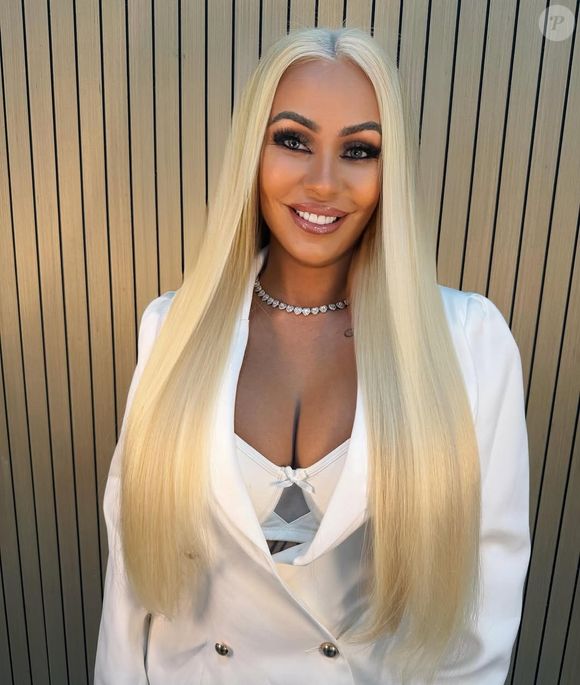 Débora Dunhill, ex-Miss Bumbum, teve uma reação alérgica após passar o sangue da própria menstruação no rosto como uma técnica alternativa de skin care