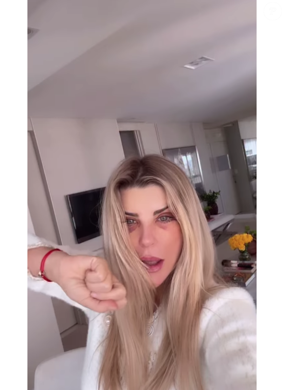 Íris Stefanelli fez lifting facial com deep plane, deep neck e elevação endoscópica da sobrancelha