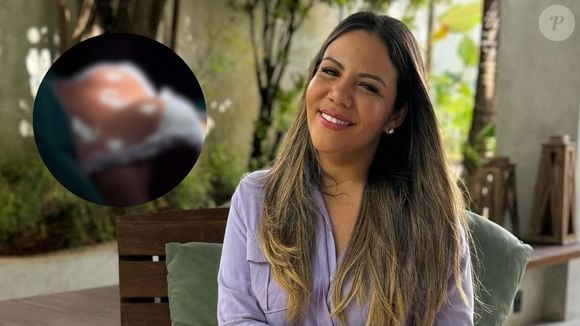 Mani Rego, ex-namorada do campeão do 'BBB 24', Davi Brito, também recorreu recentemente ao procedimento Mommy Makeover