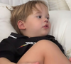 José Leonardo, filho de Virgínia e Zé Felipe, de 2 anos, bate o nariz e leva 5 pontos; pai revela susto: 'Sai muito sangue'