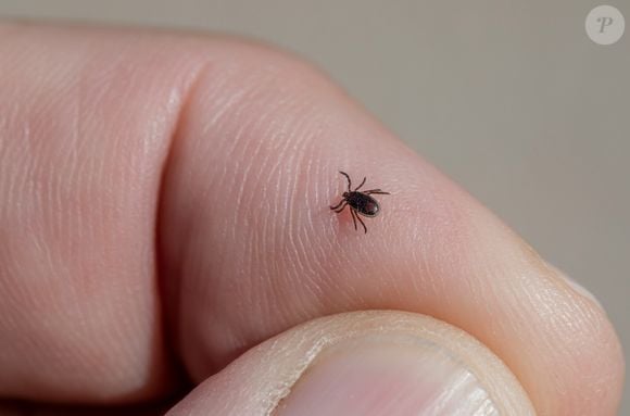 Segundo o psiquiatra Dr. José Carbonell, a "síndrome do carrapato" indica que relacionamentos desequilibrados costumam causar danos em nossa saúde física e psicológica