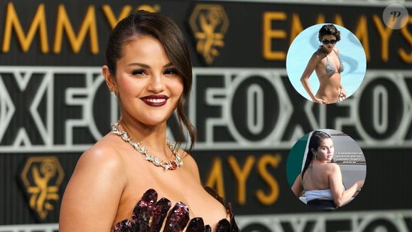 Selena Gomez mostra antes e depois do corpo e desabafa sobre mudanças