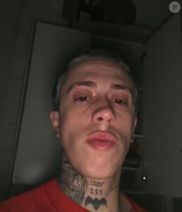 MC Daniel colocou lentes de contato logo no início da carreira