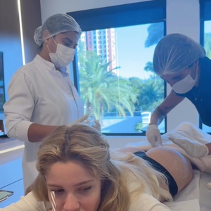 Karoline Lima aplicou 60ml de ácido hialurônico e 80ml de bioestimulador de colágeno no bumbum para definir a região