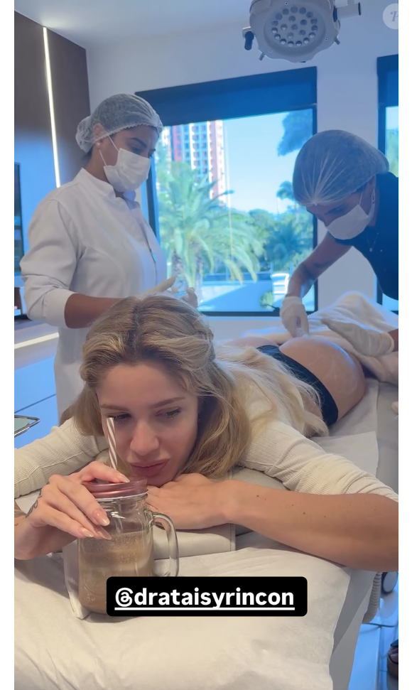 Karoline Lima aplicou 60ml de ácido hialurônico e 80ml de bioestimulador de colágeno no bumbum para definir a região