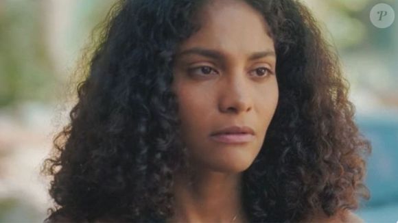 Especialistas reforçam importância do acompanhamento médico sobre casos de lipedema como o de Bárbara Reis