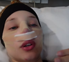 A influenciadora Malu Borges, conhecida por looks e bolsas excêntricas, realizou uma rinoplastia recentemente