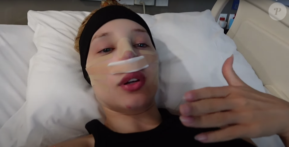 A influenciadora Malu Borges, conhecida por looks e bolsas excêntricas, realizou uma rinoplastia recentemente