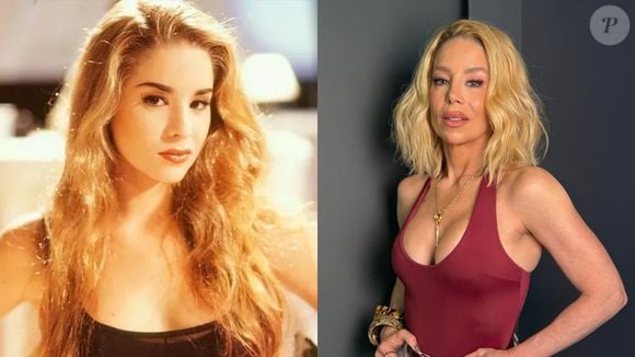 Antes e depois de Danielle Winits: apesar de sutil, rinoplastia da atriz garantiu um nariz mais levantado e fino