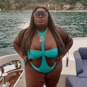 O que ninguém conta sobre as cirurgias plásticas pós-obesidade da Jojo Todynho