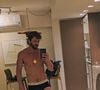 Diogo Venturieri entrou para o universo +18 por falta de oportunidades na televisão. “É inacreditável eu ter que fazer esse tipo de filme pra aparecer… mas é o que eu posso fazer no momento. Eu sou ator, sou cantor, faço o que posso”