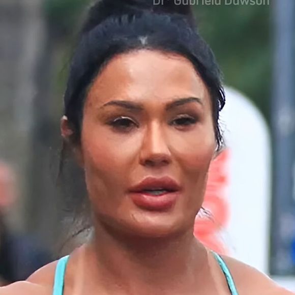 Gracyanne Barbosa resolveu reverter os procedimentos estéticos do seu rosto há alguns meses