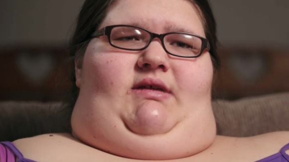 Antes e depois de Megan, do 'Quilos Mortais': pesando 274 quilos aos 24 anos, jovem perdeu mais de 100 kg com bariátrica e tomou atitude radical