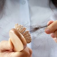 Ozempic para emagrecer: médica alerta sobre efeito colateral grave no cabelo após Jojo Todynho e Suzanna Freitas assumirem uso do remédio