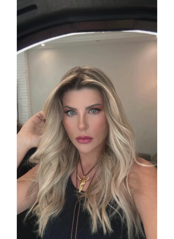 Mais recentemente, Íris Stefanelli passou por um novo combo de procedimentos estéticos