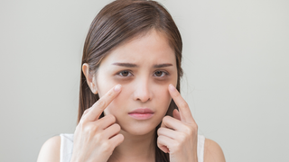 Adeus olheiras! Não acredito que consegui reduzir as minhas com este produto simples e barato