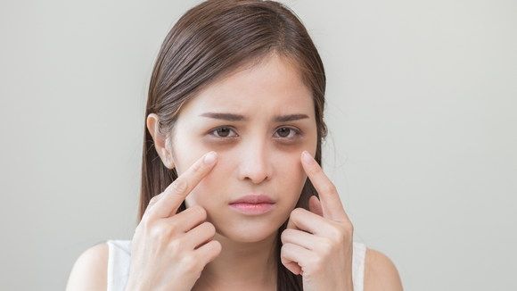 Adeus olheiras! Não acredito que consegui reduzir as minhas com este produto simples e barato