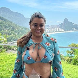 Mesmo com a cirurgia, Preta Gil precisou usar uma bolsa de ileostomia por um tempo